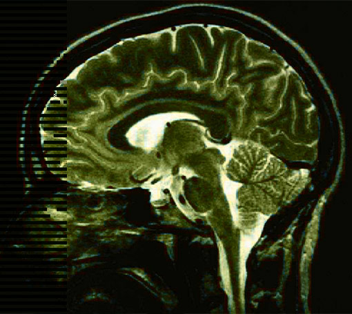 Especialista en Neurología